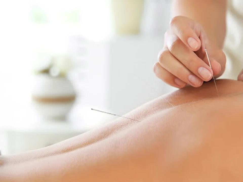 Acupuncture Marilyne Giguère | Acupunctrice, Équilibre, Holistique et Lifting à Québec